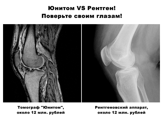 Сравнение с рентгеном